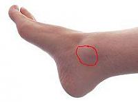 Нажмите на изображение для увеличения
Название: 220px-Male_Right_Foot_1.jpg
Просмотров: 621
Размер: 3.9 Кб
ID: 11925